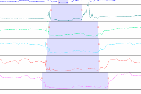 24 órás pH mérés – impedancia vizsgálattal